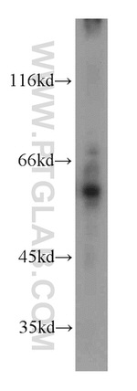 MTA3 Antibody in Western Blot (WB)