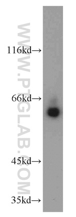 MTA3 Antibody in Western Blot (WB)
