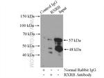 RXRB Antibody in Immunoprecipitation (IP)