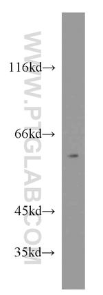 RXRB Antibody in Western Blot (WB)