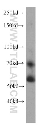 RXRB Antibody in Western Blot (WB)