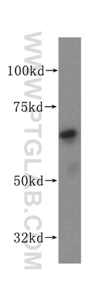 PAK4 Antibody in Western Blot (WB)