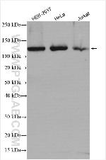 DIS3 Antibody in Western Blot (WB)