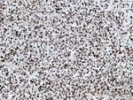 AGAP2 Antibody in Immunohistochemistry (Paraffin) (IHC (P))