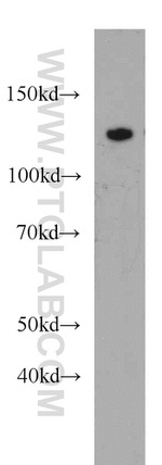 AGAP2 Antibody in Western Blot (WB)