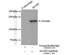 AGAP2 Antibody in Immunoprecipitation (IP)