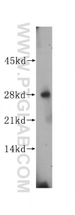 AMN1 Antibody in Western Blot (WB)