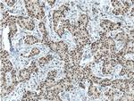 ATF7IP Antibody in Immunohistochemistry (Paraffin) (IHC (P))
