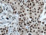 ATF7IP Antibody in Immunohistochemistry (Paraffin) (IHC (P))