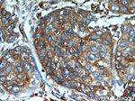 GRP94 Antibody in Immunohistochemistry (Paraffin) (IHC (P))