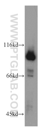 GRP94 Antibody in Western Blot (WB)