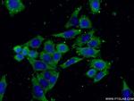 RPL19 Antibody in Immunocytochemistry (ICC/IF)