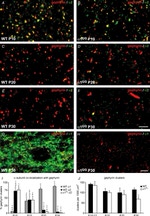 IL-1 alpha Antibody in Immunohistochemistry (IHC)