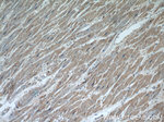 MAP4K3 Antibody in Immunohistochemistry (Paraffin) (IHC (P))