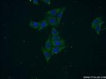 SEC6 Antibody in Immunocytochemistry (ICC/IF)