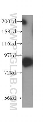 SEC6 Antibody in Western Blot (WB)