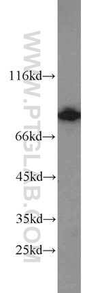 SEC6 Antibody in Western Blot (WB)