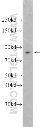 SEC6 Antibody in Western Blot (WB)