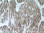 C14orf2 Antibody in Immunohistochemistry (Paraffin) (IHC (P))