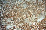UBXD1 Antibody in Immunohistochemistry (Paraffin) (IHC (P))