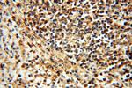 UBXD1 Antibody in Immunohistochemistry (Paraffin) (IHC (P))