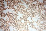 UBXD1 Antibody in Immunohistochemistry (Paraffin) (IHC (P))