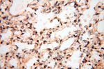 UBXD1 Antibody in Immunohistochemistry (Paraffin) (IHC (P))