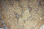 UBXD1 Antibody in Immunohistochemistry (Paraffin) (IHC (P))