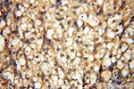 UBXD1 Antibody in Immunohistochemistry (Paraffin) (IHC (P))