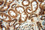 UBXD1 Antibody in Immunohistochemistry (Paraffin) (IHC (P))
