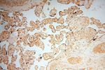 UBXD1 Antibody in Immunohistochemistry (Paraffin) (IHC (P))