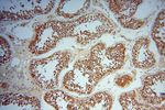 UBXD1 Antibody in Immunohistochemistry (Paraffin) (IHC (P))