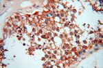 UBXD1 Antibody in Immunohistochemistry (Paraffin) (IHC (P))