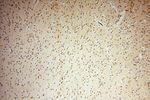 UBXD1 Antibody in Immunohistochemistry (Paraffin) (IHC (P))