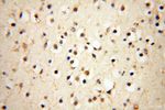 UBXD1 Antibody in Immunohistochemistry (Paraffin) (IHC (P))
