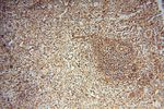 UBXD1 Antibody in Immunohistochemistry (Paraffin) (IHC (P))