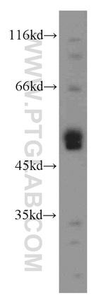 UBXD1 Antibody in Western Blot (WB)