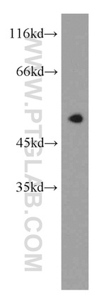 UBXD1 Antibody in Western Blot (WB)