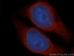 UBXD1 Antibody in Immunocytochemistry (ICC/IF)