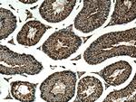 UBXD1 Antibody in Immunohistochemistry (Paraffin) (IHC (P))
