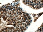 UBXD1 Antibody in Immunohistochemistry (Paraffin) (IHC (P))
