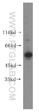 UBXD1 Antibody in Western Blot (WB)