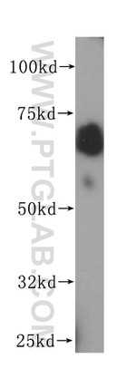 PAPSS1 Antibody in Western Blot (WB)