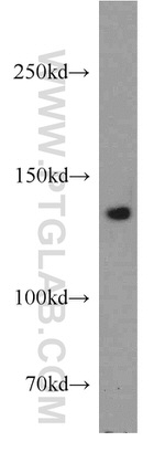 MGEA5 Antibody in Western Blot (WB)