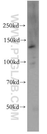 MGEA5 Antibody in Western Blot (WB)