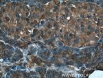 MGEA5 Antibody in Immunohistochemistry (Paraffin) (IHC (P))