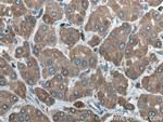 ERp72 Antibody in Immunohistochemistry (Paraffin) (IHC (P))