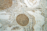 NF45 Antibody in Immunohistochemistry (Paraffin) (IHC (P))