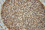 NF45 Antibody in Immunohistochemistry (Paraffin) (IHC (P))