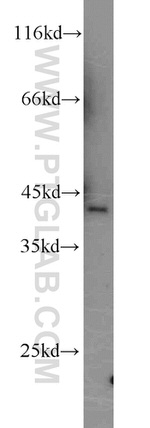 NF45 Antibody in Western Blot (WB)